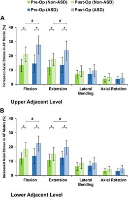 Anatomical parameters alter the biomechanical responses of adjacent segments following lumbar fusion surgery: Personalized poroelastic finite element modelling investigations